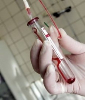 60 de constănţeni, confirmaţi în 2012 cu virusul HIV